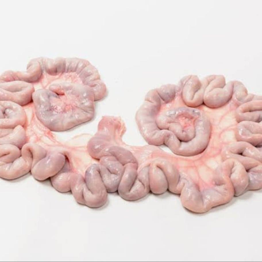 Uterus